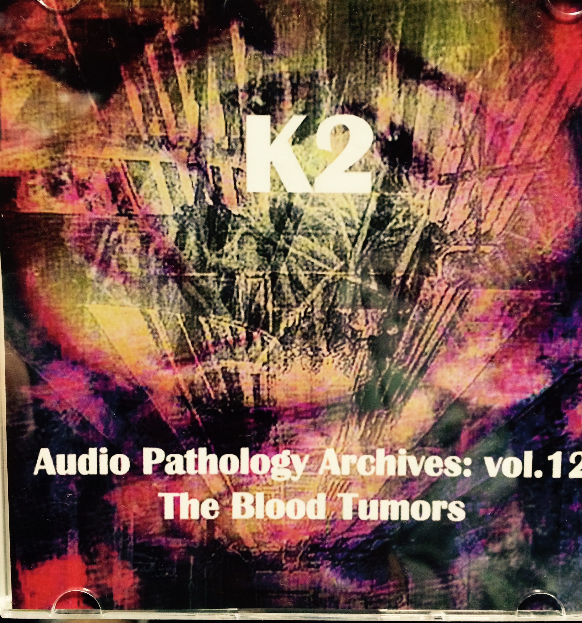 K2 「音響病理学記録集第12巻:血液腫瘍」